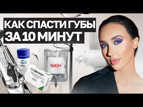 Видео: КАК УБРАТЬ ФИЛЛЕР ИЗ ГУБ? Секреты коррекции от врача с 12-летним стажем! 💉