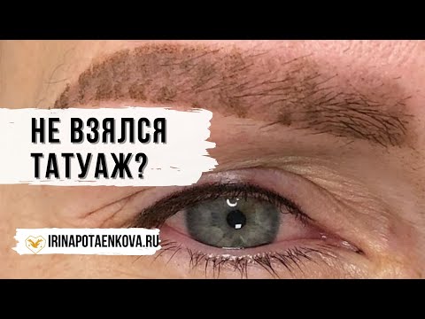 Видео: Татуаж НЕ ВЗЯЛСЯ😱 Травматизация кожи