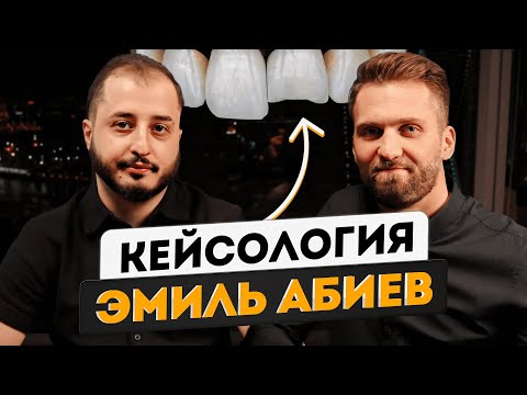 Видео: Эмиль Абиев - Реставрация  центрального резца 21 | Фронтальная реставрация | кейсология