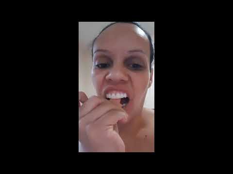 Видео: Как правильно одевать зубной протез