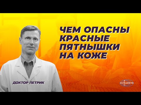 Видео: Чем опасны красные пятнышки на коже.