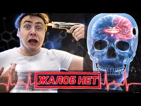 Видео: неСмертельные ранения мозга | Истории выживших