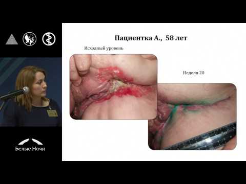 Видео: Лекарственное лечение базально-клеточного рака