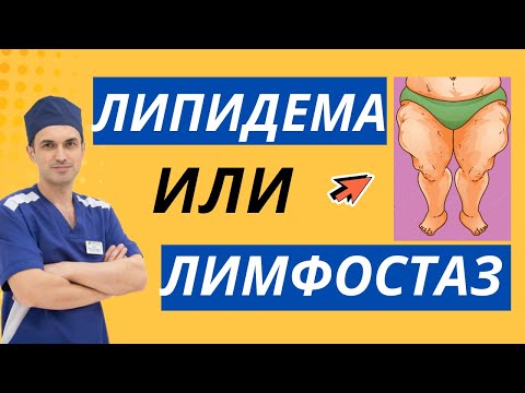 Видео: Липидема что это? Отличие от лимфостаза. Флеболог, лимфолог Москва.