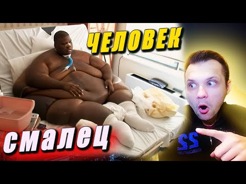 Видео: ШОК ЧЕЛОВЕК СМАЛЕЦ | Больница для толстяков