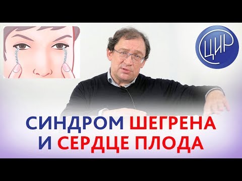 Видео: СИНДРОМ ШЕГРЕНА и беременность. Как снизить риск БЛОКАДЫ СЕРДЦА плода при аутоиммунном синдроме.