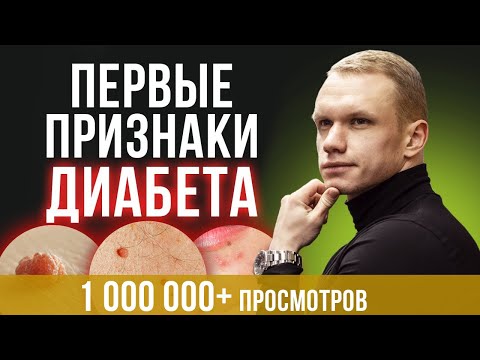 Видео: 7 главных признаков диабета / Как понять что у вас преддиабет?