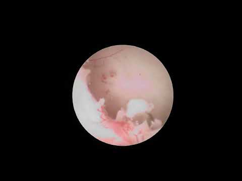 Видео: с марвел 613899