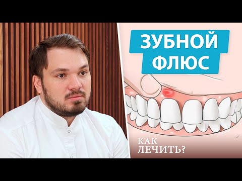 Видео: Флюс - симптомы и стадии лечения (периостит зуба)