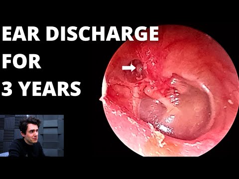 Видео: Что-то не так с этим ухом... (ЭПИЗОД 2)