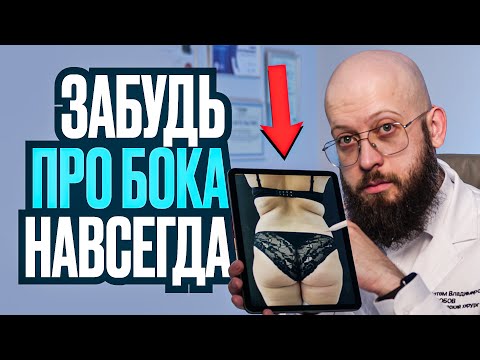 Видео: Липосакция боков - Как убрать бока женщине с помощью пластики? Примеры липосакции