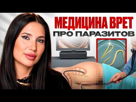 Видео: РАЗОБЛАЧЕНИЕ ЛЖИ О ПАРАЗИТАХ! Как врачи Вам не договаривают