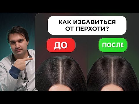 Видео: Как навсегда вылечить ПЕРХОТЬ?