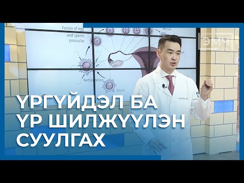 Видео: 116 - Үргүйдэл ба Үр шилжүүлэн суулгах / Цахим Эмч шоу