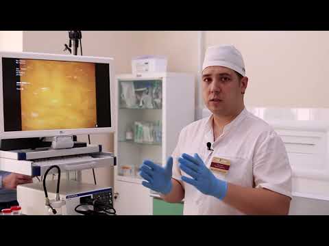 Видео: Кошечкин Андрей Сергеевич - Цистоскопия (случай из практики)