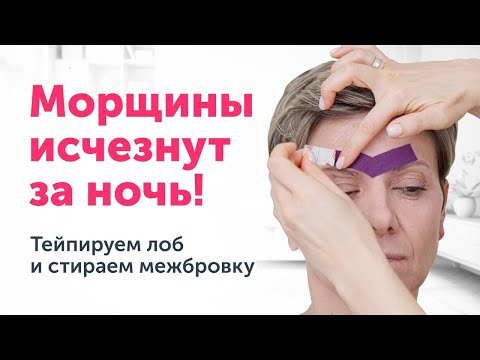 Видео: ТЕЙПИРОВАНИЕ: МЕЖБРОВКА ИСЧЕЗНЕТ ЗА НОЧЬ. Мастер-класс. Тейпируем лоб