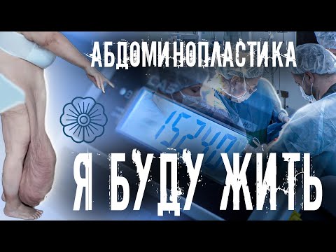 Видео: АБДОМИНОПЛАСТИКА. ХОЧУ ЖИТЬ