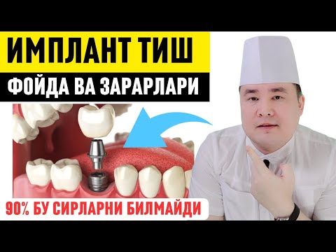 Видео: ИМПЛАНТ ПРОТЕЗ ТИШ ҚЎЙДИРИШНИ ФОЙДА ВА ЗАРАРЛАРИ ҲАҚИДА / 90% БИЛМАЙДИГАН СИРЛАР / ИСЧАНОВ