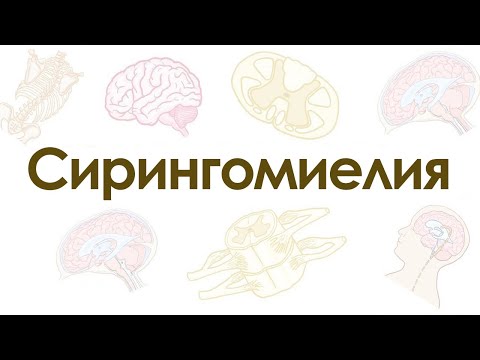 Видео: Сирингомиелия