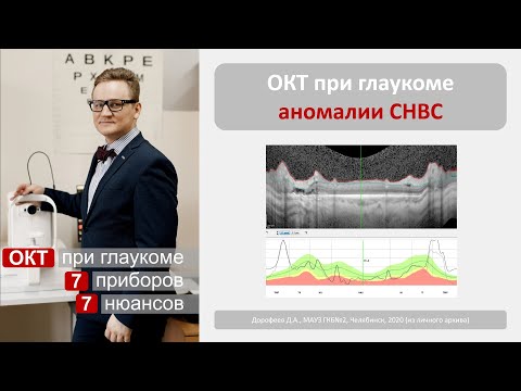 Видео: ОКТ при глаукоме. Ошибки сегментации, аномалии СНВС.