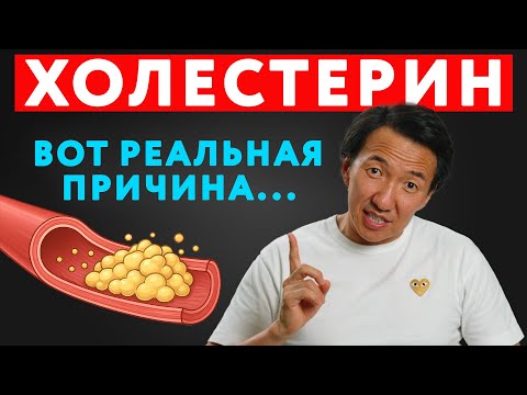 Видео: ВОТ ПОЧЕМУ у вас высокий ХОЛЕСТЕРИН! //  #докторЖимба