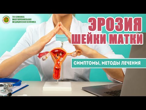 Видео: ЭРОЗИЯ ШЕЙКИ МАТКИ (Эндоцервикоз или эндоцервицит) - симптомы, методы лечения, рекомендации