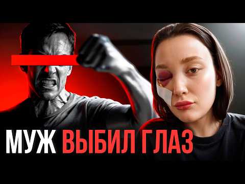 Видео: 😱 «Муж выбил глаз, угрожал сy*ци&ом, а я сама хотела выпрыгнуть в окно»