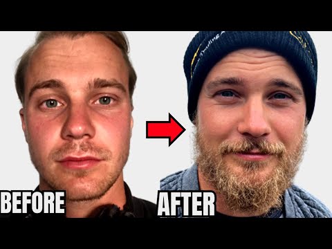 Видео: ЕДИНСТВЕННЫЙ совет, который вам нужен, чтобы отрастить бороду