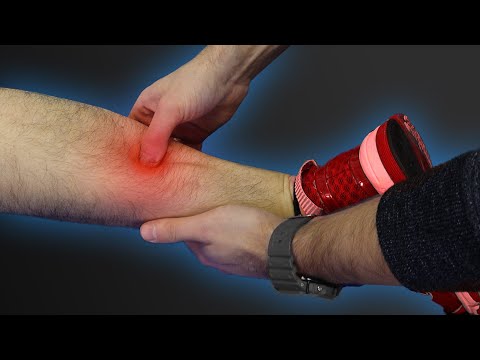 Видео: Основные проблемные места бегуна - Как найти и массировать