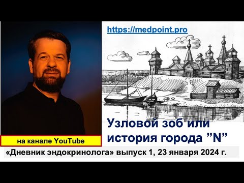 Видео: "Узловой зоб или история города N"