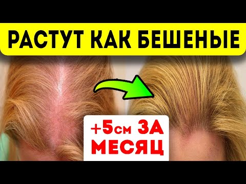 Видео: ПРЕДУПРЕЖДАЕМ СРАЗУ: на лицо и руки не наносить! Волосы растут как бешеные — всего одна капля…