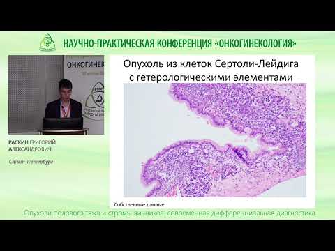 Видео: Опухоли полового тяжа и стромы яичников
