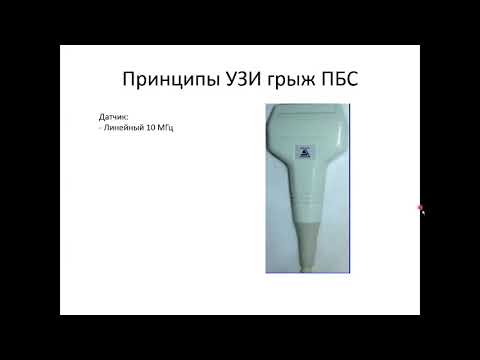 Видео: УЗ диагностика грыж передней брюшной стенки
