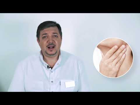 Видео: Почему у людей небные миндалины могут выглядеть по разному?