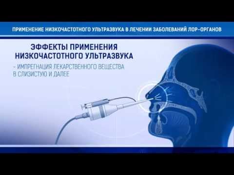 Видео: Тонзиллор-ММ - аппарат ультразвуковой низкочастотный