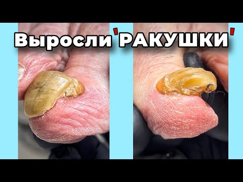 Видео: Красиво уже не будет | #подологтатьянапак