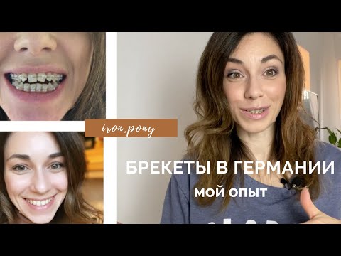 Видео: БРЕКЕТЫ В ГЕРМАНИИ, СКОЛЬКО ЭТО СТОИТ И ЧТО НУЖНО ЗНАТЬ