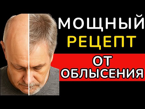 Видео: НАНЕСИ ЭТО на голову — выпадение прекратится, а ВОЛОСЫ СТАНУТ ГУСТЫМИ НАВСЕГДА !