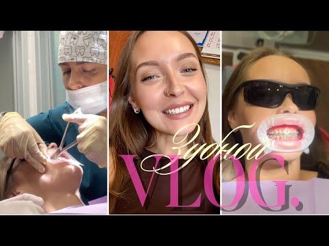 Видео: Зубной влог: снятие брекетов, жизнь с новыми зубами, первая реакция, дальнейшие планы 