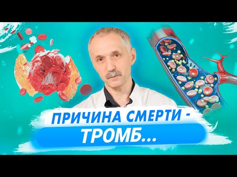 Видео: Причина смерти - тромб... / Доктор Виктор