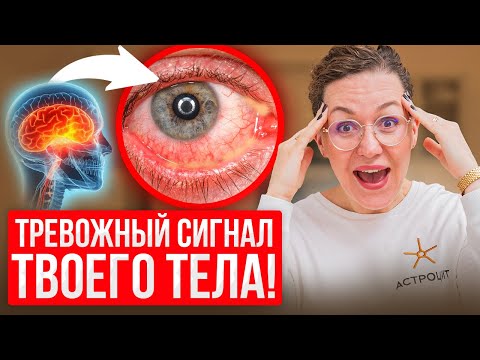 Видео: САМАЯ СИЛЬНАЯ БОЛЬ в мире! Как ВЫЖИТЬ при кластерной головной боли?