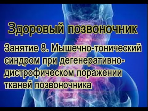 Видео: Занятие 8.  Мышечно-тонический синдром в больном позвоночнике при ДДИ.