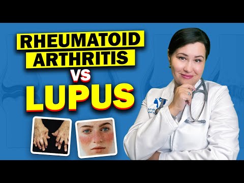 Видео: Ревматоидный артрит и волчанка одновременно?!