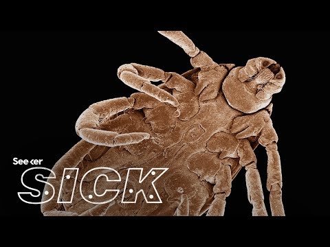 Видео: Какое воздействие оказывает болезнь Лайма на ваш организм?