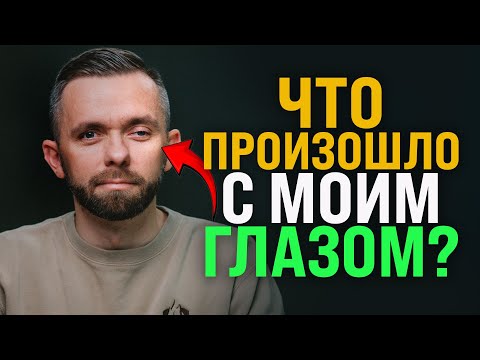 Видео: Что произошло с моим глазом?