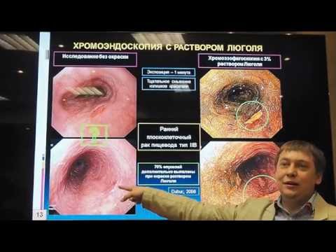 Видео: 03 Пирогов СС Классификации и интерпретация поражений слизистой оболочки пищевода