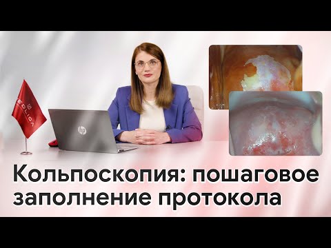 Видео: Заполнение протокола кольпоскопии и кольпоскопическое заключение в программе «Кольпоэксперт»