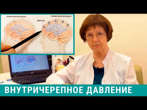 Видео: Внутричерепное давление (ВЧД): причины, симптомы, лечение внутричерепного давления