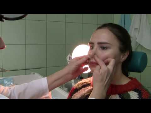 Видео: Второй видеоурок "Отоларингологи для врачей первичного звена"