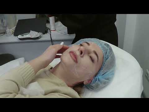 Видео: Мастер класс по канюльным техникам